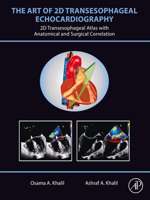 cover image of The Art of 2D Transesophageal Echocardiography